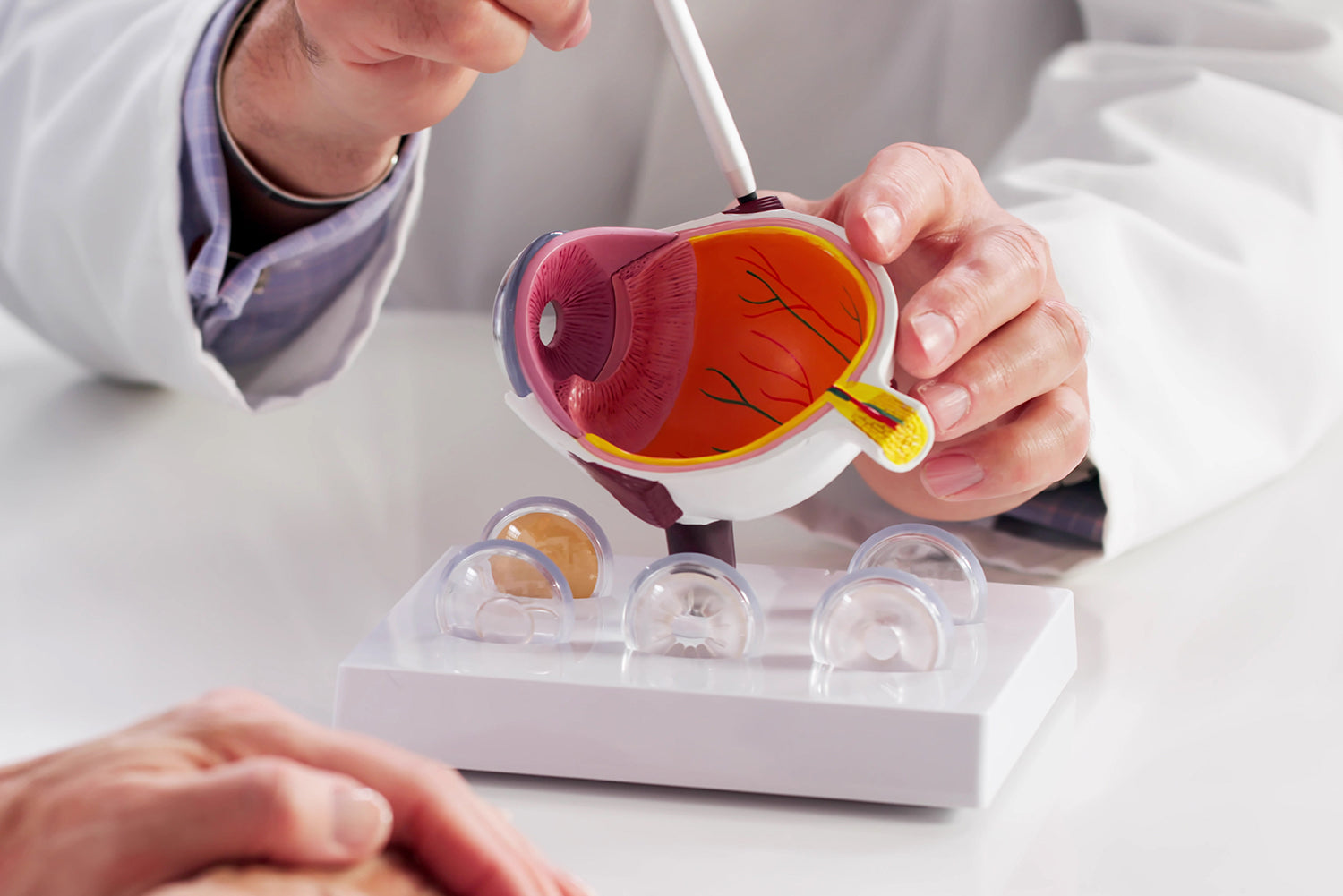 Tension oculaire et hypertension oculaire : comprendre l’équilibre de la pression intraoculaire et les approches de soutien