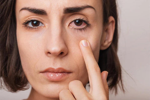 Trockene Augen: Wie kann man es auf natürliche Weise verhindern?