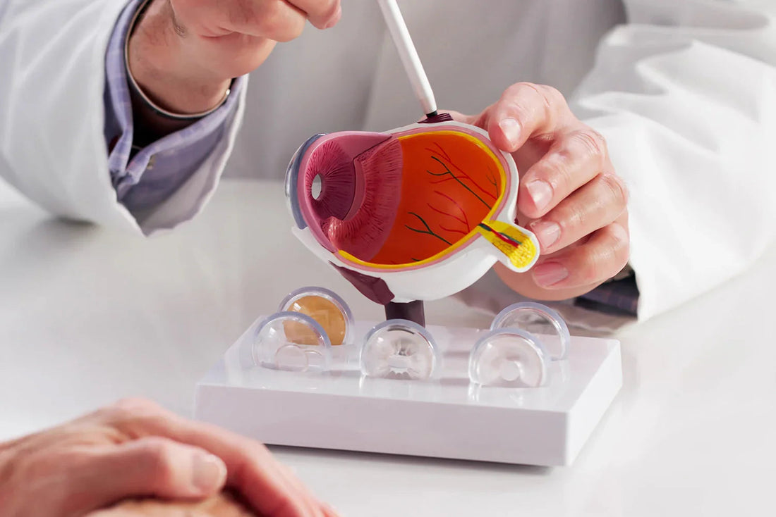 Tension oculaire et hypertension oculaire : comprendre l’équilibre de la pression intraoculaire et les approches de soutien